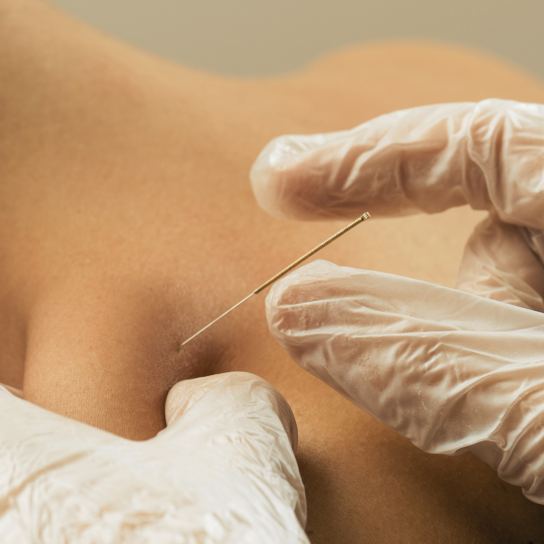 Untitled design (23)